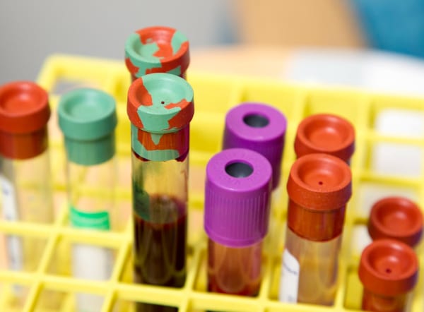 Imagen que representa el servicio de Déficits nutricionales